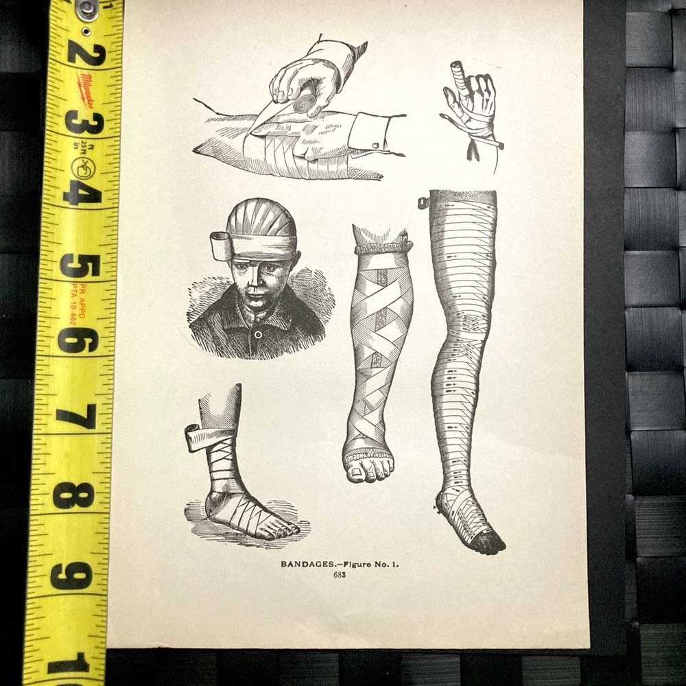 Vintage Medical Diagram | Bandages | Circa 1903